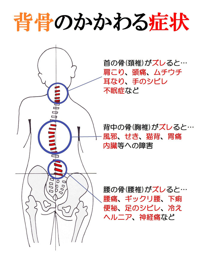 肩こり 腰痛 新発田で整体 カイロ矯正なら カイロオフィスこばやし Seitai Kobayasi Sibatasi ページ