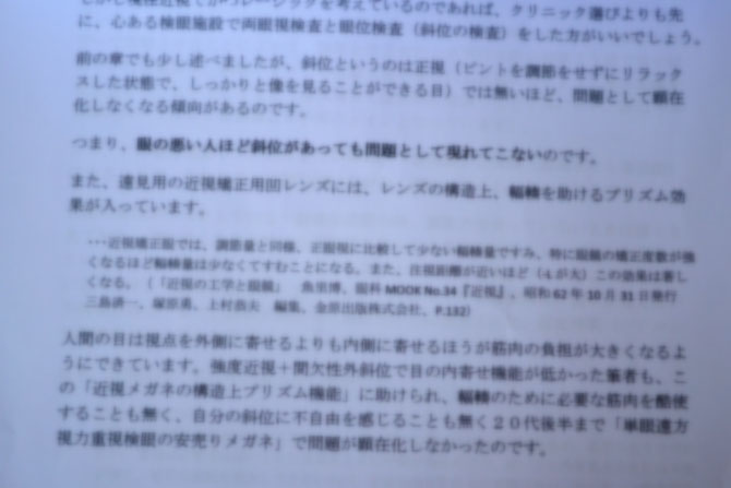 不正乱視は角膜に不規則な凹凸が生じているために発生する乱視である。眼鏡では矯正が難しい。