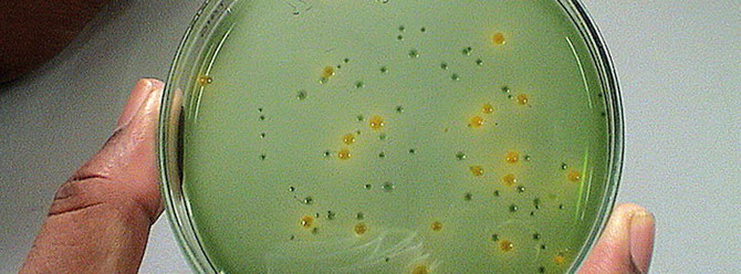 Agarplatten in Petrischalen dienen als Nährboden für die Mikrobiologie. Foto: Michael Wolfinger