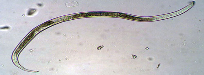 Ein Fadenwurm der bei 100facher Vergrößerung unter dem Mikroskop aufgenommen wurde. Foto: Moos-AG