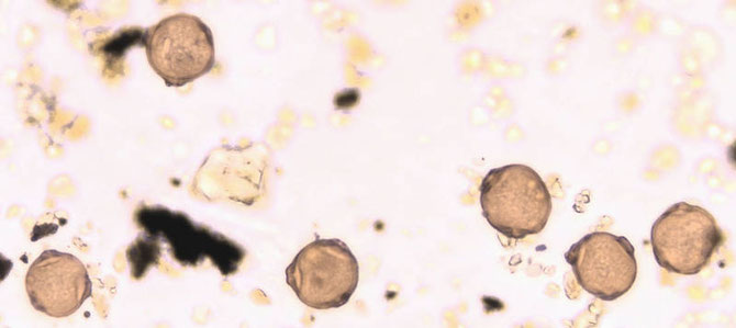 Mikroskopisch kleines Ärgernis: Birkenpollen in der Nahaufnahme  (Foto: UNIKA-T)
