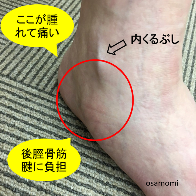 内くるぶし付近が痛い場合 後脛骨筋腱の不調かも 外反母趾 膝痛 タコ魚の目専門 競歩技術を取り入れたウォーキング教室を開催 日常生活動作を改善し痛い 辛いを解消 昭島市の 安心女性の整体院 内くるぶし付近が痛い場合 後脛骨筋腱の不調かも 外反母趾 膝痛 タコ魚の目専門 競歩技術を取り入れたウォーキング教室を開催 日常生活動作を改善し痛い 辛いを解消 昭島市の 安心女性の整体院