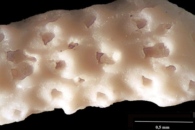 Senckenberg, Bryozoa, Bryozoen, Moostierchen, Sammlung Voigt