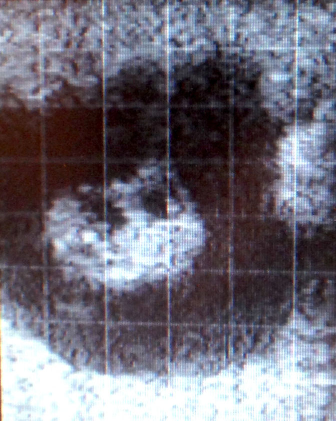 Pferde-Embryo im Ultraschallbild mit ca. 6 Wochen