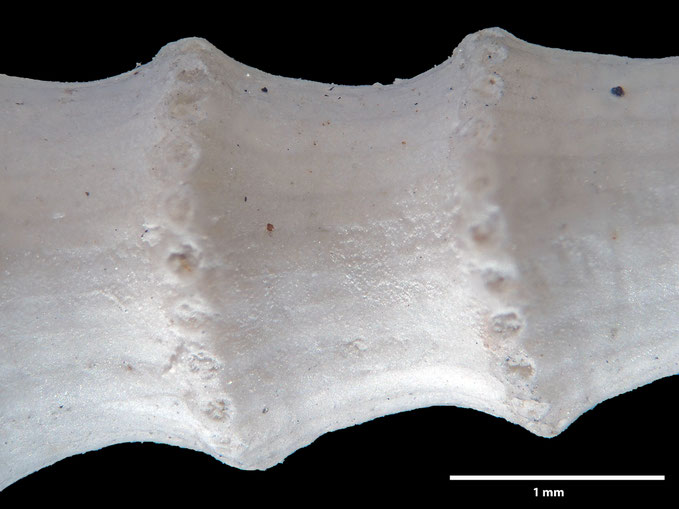 Senckenberg, Bryozoa, Bryozoen, Moostierchen, Sammlung Voigt