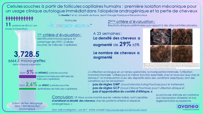 article clinique Dr Gentile traitement de l'alopécie androgénique avec Rigenera