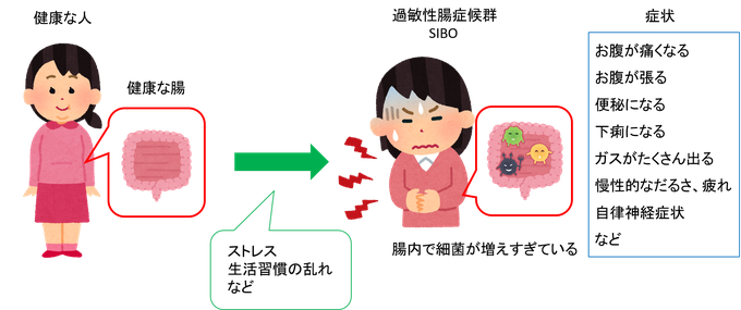 SIBO が原因の胃腸の不調はガスによるもの