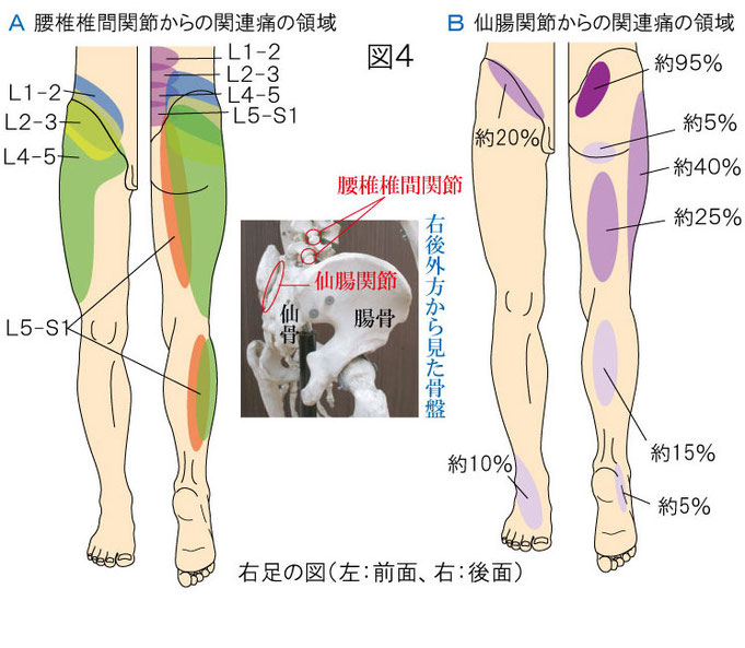 腰椎椎間関節と仙腸関節の関連痛領域