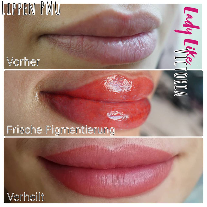 Lippen Pigmentierung im Prozess