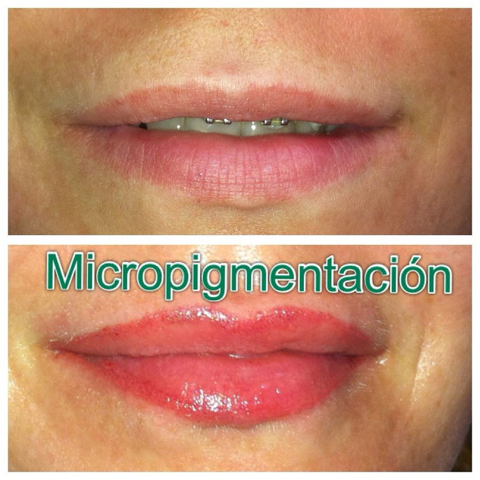 Speedylips natural