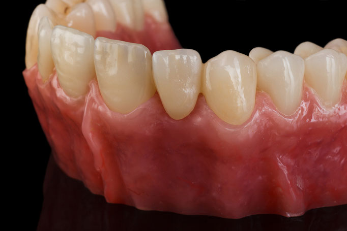 STUDIO -SEIKEL werbefotografie / Der Spezialist für Dentalfotografie / Zahnmedizin / Interdentalfotografie / Zähne / Implantate / Kronen / Veneers