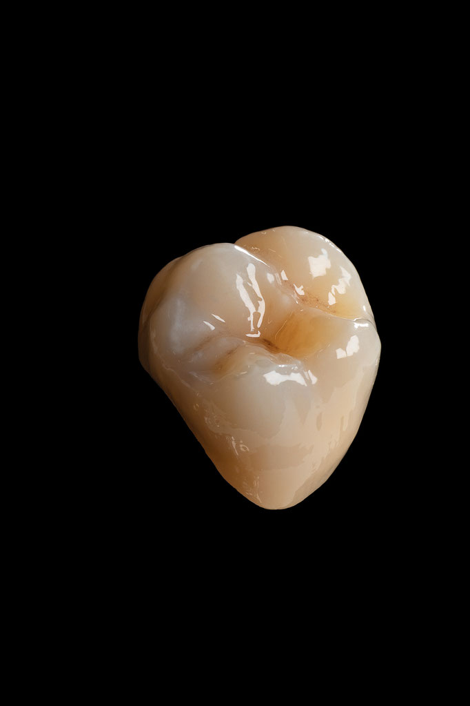 STUDIO -SEIKEL werbefotografie / Der Spezialist für Dentalfotografie / Zahnmedizin / Interdentalfotografie / Zähne / Implantate / Kronen / Veneers