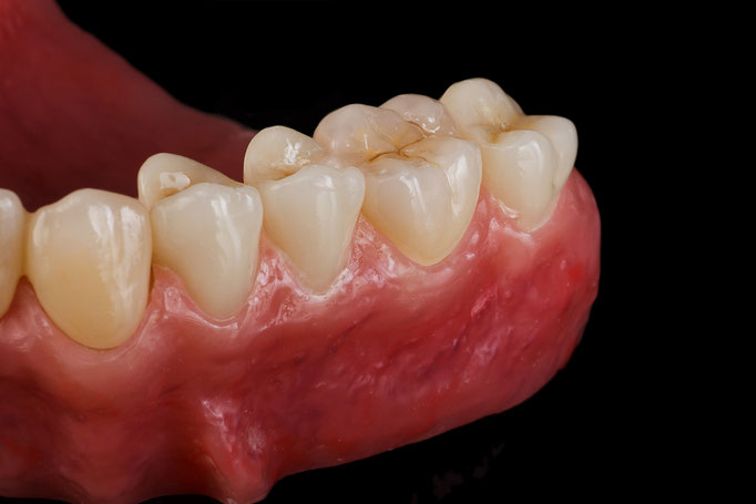 STUDIO -SEIKEL werbefotografie / Der Spezialist für Dentalfotografie / Zahnmedizin / Interdentalfotografie / Zähne / Implantate / Kronen / Veneers