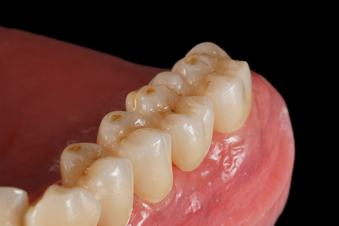 STUDIO -SEIKEL werbefotografie / Der Spezialist für Dentalfotografie / Zahnmedizin / Interdentalfotografie / Zähne / Implantate / Kronen / Veneers