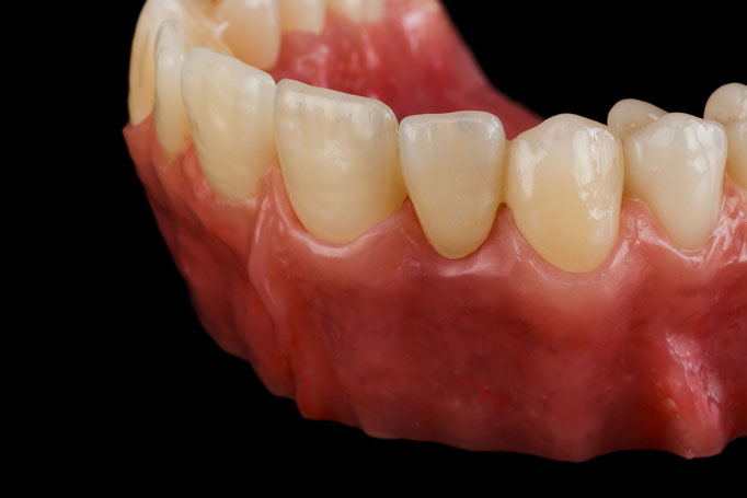 STUDIO -SEIKEL werbefotografie / Der Spezialist für Dentalfotografie / Zahnmedizin / Interdentalfotografie / Zähne / Implantate / Kronen / Veneers