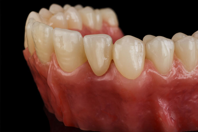 STUDIO -SEIKEL werbefotografie / Der Spezialist für Dentalfotografie / Zahnmedizin / Interdentalfotografie / Zähne / Implantate / Kronen / Veneers