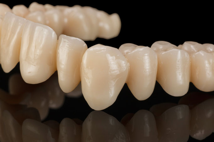 STUDIO -SEIKEL werbefotografie / Der Spezialist für Dentalfotografie / Zahnmedizin / Interdentalfotografie / Zähne / Implantate / Kronen / Veneers