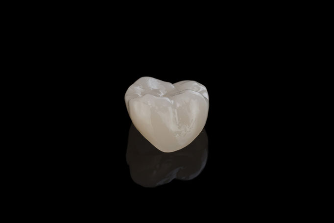 STUDIO -SEIKEL werbefotografie / Der Spezialist für Dentalfotografie / Zahnmedizin / Interdentalfotografie / Zähne / Implantate / Kronen / Veneers