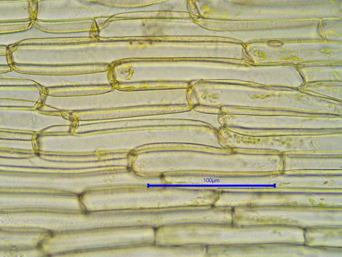 Bild 15 Zellen der Blattscheide im Bereich der Mitte
