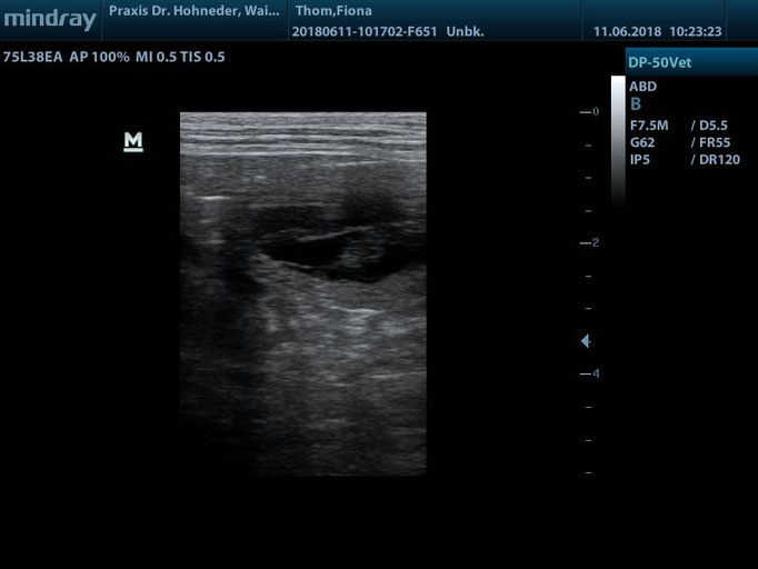 Embryo 3 - chillt schon auf dem Rücken wie Mama... ;-)