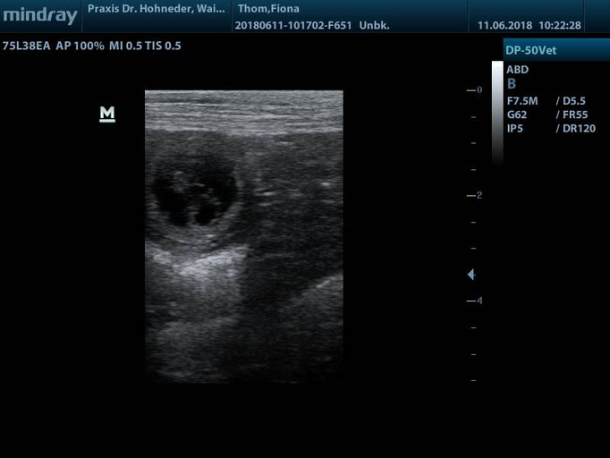 Embryo 2