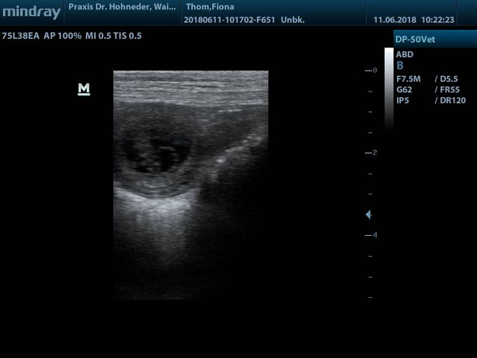 Embryo 1