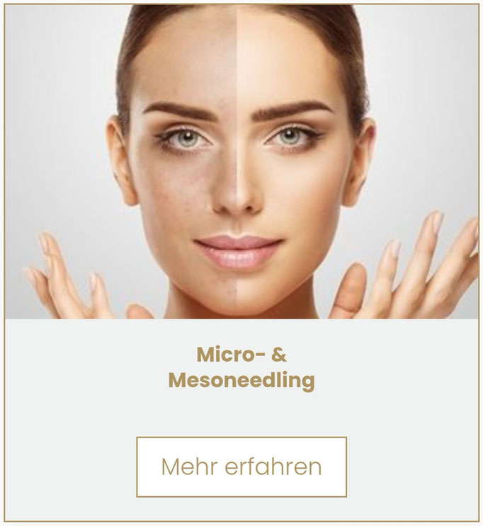 Microneedling