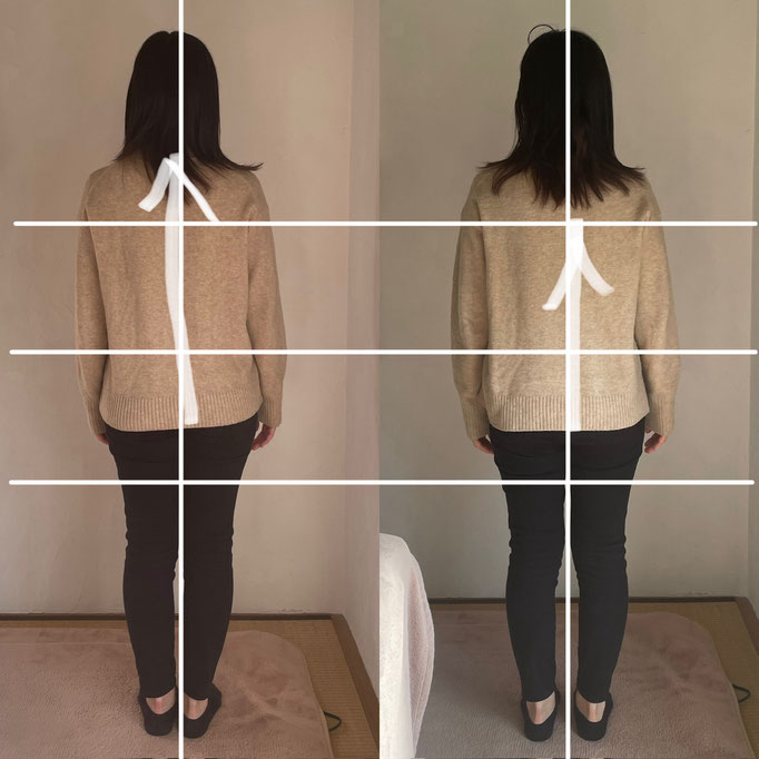 30代女性/足や全身のむくみ/腰痛/首の痛み　 　（疲れてくると骨盤がゆがみ下半身が浮腫むそうでしたが、現在は浮腫まなくなったそうです）