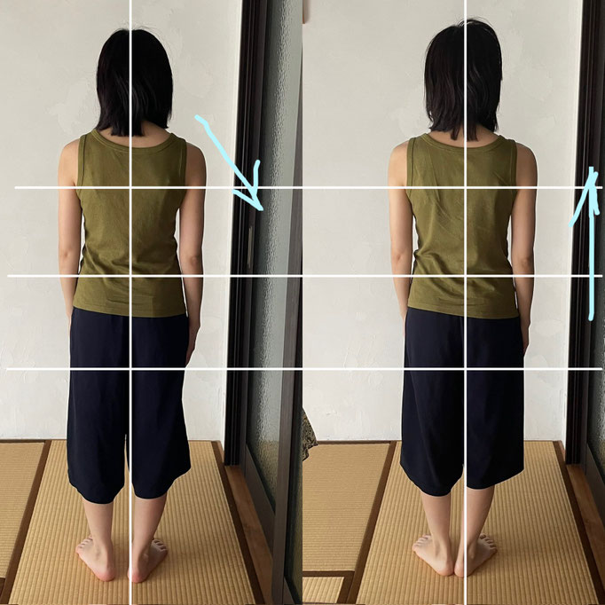 20代女性/自律神経失調症/呼吸や喉の違和感/頭痛/肩こり/不安/不眠/気力低下(ストレスから不眠症で自律神経のバランスが乱れていました）