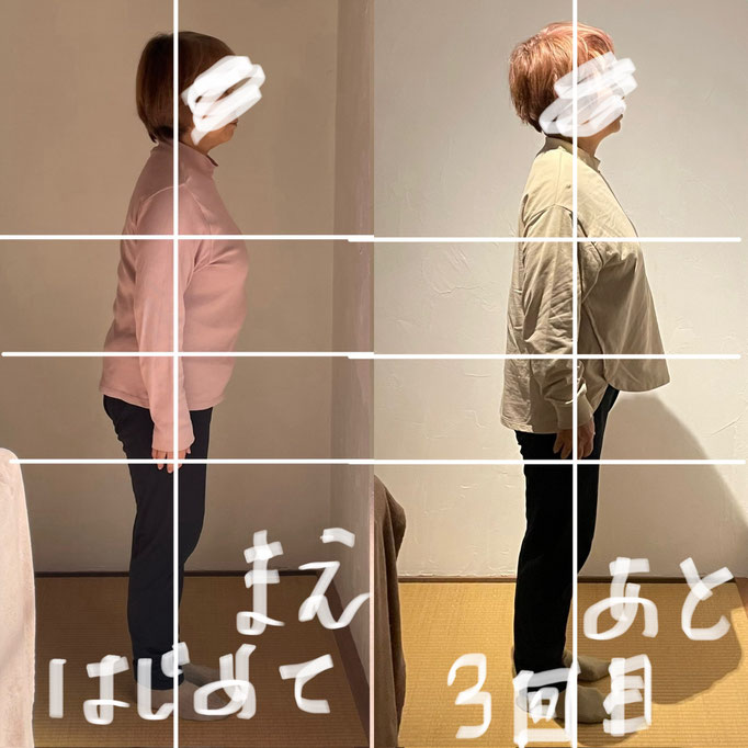 70代女性/腰痛/膝の痛み/鬱っぽい/不眠症