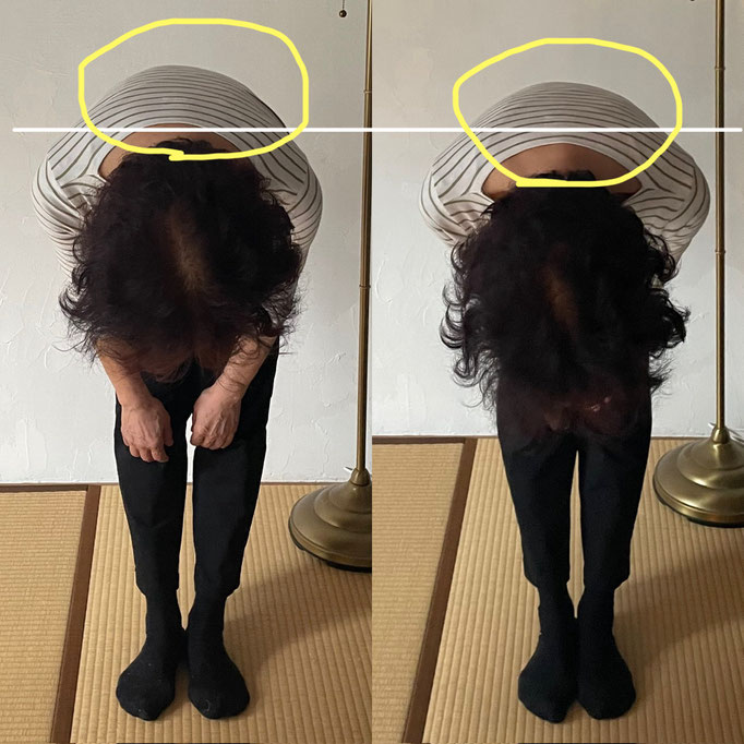 60代女性/腰痛/背中のつまり/脊椎側湾症　　 　(外出中は腰痛で駅のホームに立っているのも困難でしたがだいぶラクに改善されたそうです）