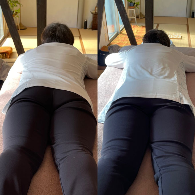 60代女性/更年期の不定愁訴/猫背/肩の痛み　　 （施術後は猫背が解消され気持ちもスッキリされるようです）