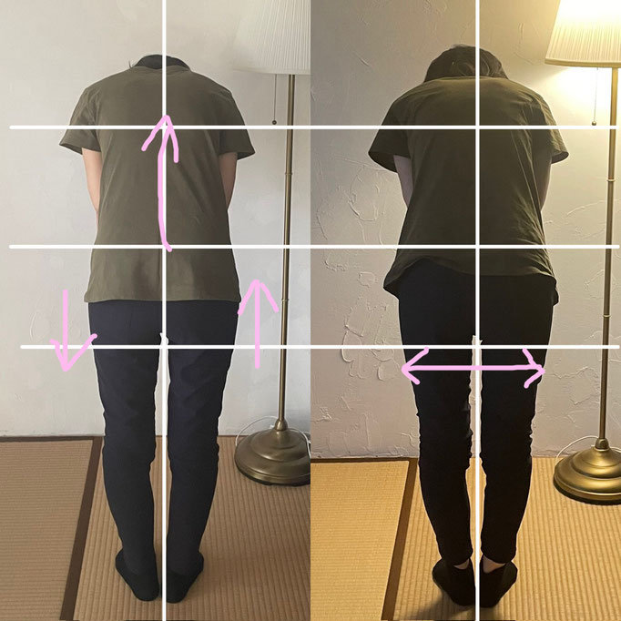 60代女性/腰痛/背中のつまり/脊椎側湾症　　 　(外出中は腰痛で駅のホームに立っているのも困難でしたがだいぶラクに改善されたそうです）
