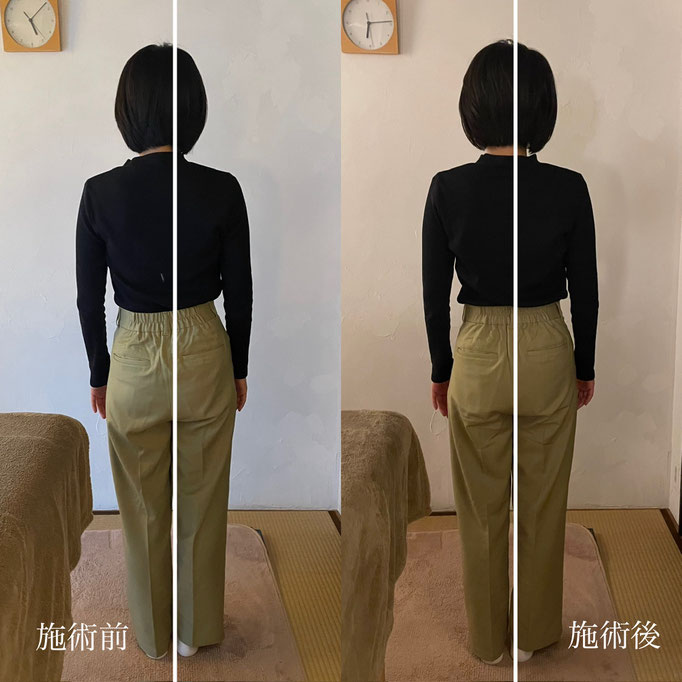 30代女性/腰痛/背中が痛む