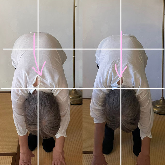 70代/脊椎側湾症/腰痛/背中の痛み/手の痛み　　(施術後、背中のつまりもなくなり身体が軽くなって腰痛も解消されるそうです）