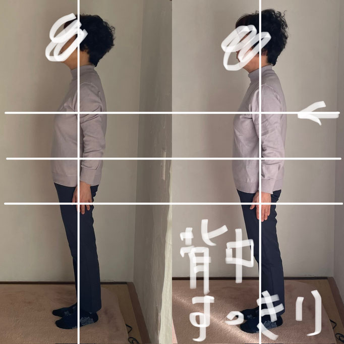 60代女性/腰痛/背中のつまり/脊椎側湾症　　 　(外出中は腰痛で駅のホームに立っているのも困難でしたがだいぶラクに改善されたそうです）