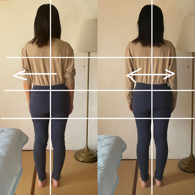 30代女性/足や全身のむくみ/腰痛/首の痛み　 　（疲れてくると骨盤がゆがみ下半身が浮腫むそうでしたが、現在は浮腫まなくなったそうです）