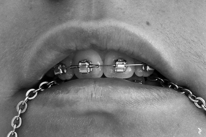 "UNCHAIN YOURSELF!" (FRANCE 2020)