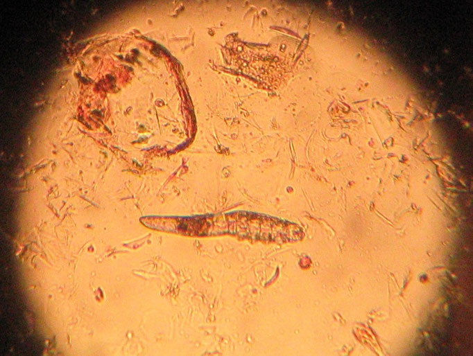 Demodexmilbe (Haarbalgmilbe) unter dem Mikroskop