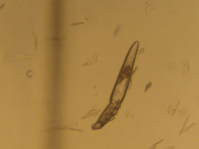 Demodexmilbe (Haarbalgmilbe) unter dem Mikroskop