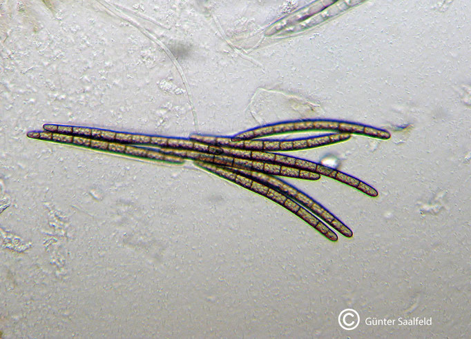 Geoglossum Spec-Erdzunge, Detailaufnahme Sporen