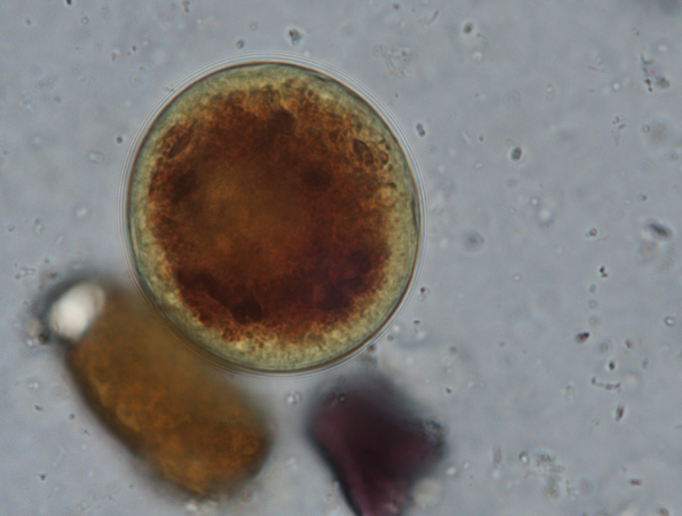Kyste de Balantidium coli coloré au Lugol