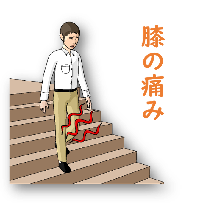 膝の痛みの図