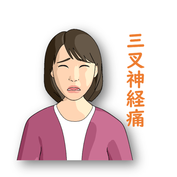 三叉神経痛の図