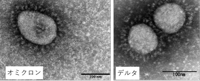国立感染研のwebサイトより