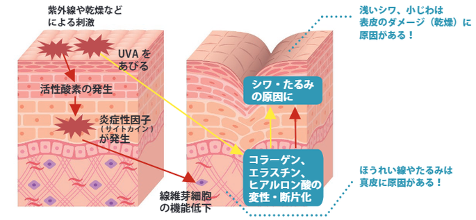 皮膚の抗老化最前線 真皮の細胞老化による慢性炎症が肌表面の凹凸に与える影響を確認