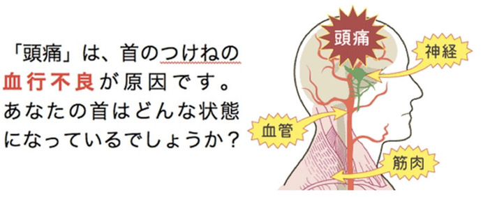 頭痛の原因