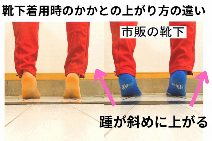 足の裏のマメの原因と改善方法