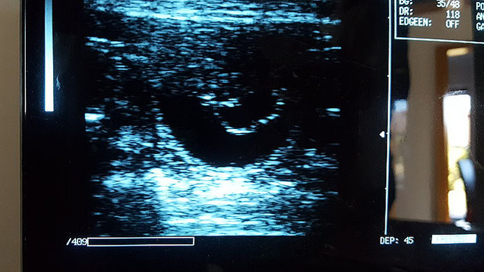 Ultraschallbild einer trächtigen Hündin