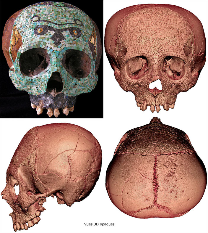 Human skull decorated with a polychromic mosaic • Mixtec-Aztec, Mexico • 1300-1521 A.D. • Tessels of turquoise, hematite and tumbaga gold sheets • H. 14.5 cm • Private collection